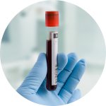Covid-19 Cord Blood Trial